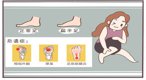 兒童康復(fù)科 | 關(guān)注扁平足，要從娃娃抓起